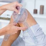 Állapotfelmérés - Renáta Gyógytorna